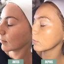 Esfoliante Facial Dermaplany™- Elimine Células Mortas e Pelos Faciais Esfoliante Facial Franco Center 