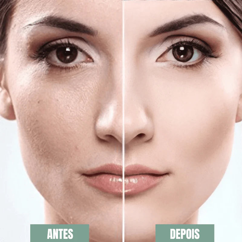 Esfoliante Facial Dermaplany™- Elimine Células Mortas e Pelos Faciais Esfoliante Facial Franco Center 