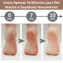 EsfoliPés® - Removedor de Calos e Rachaduras Portátil Removedor, Esfoliador dos pés Franco Center 